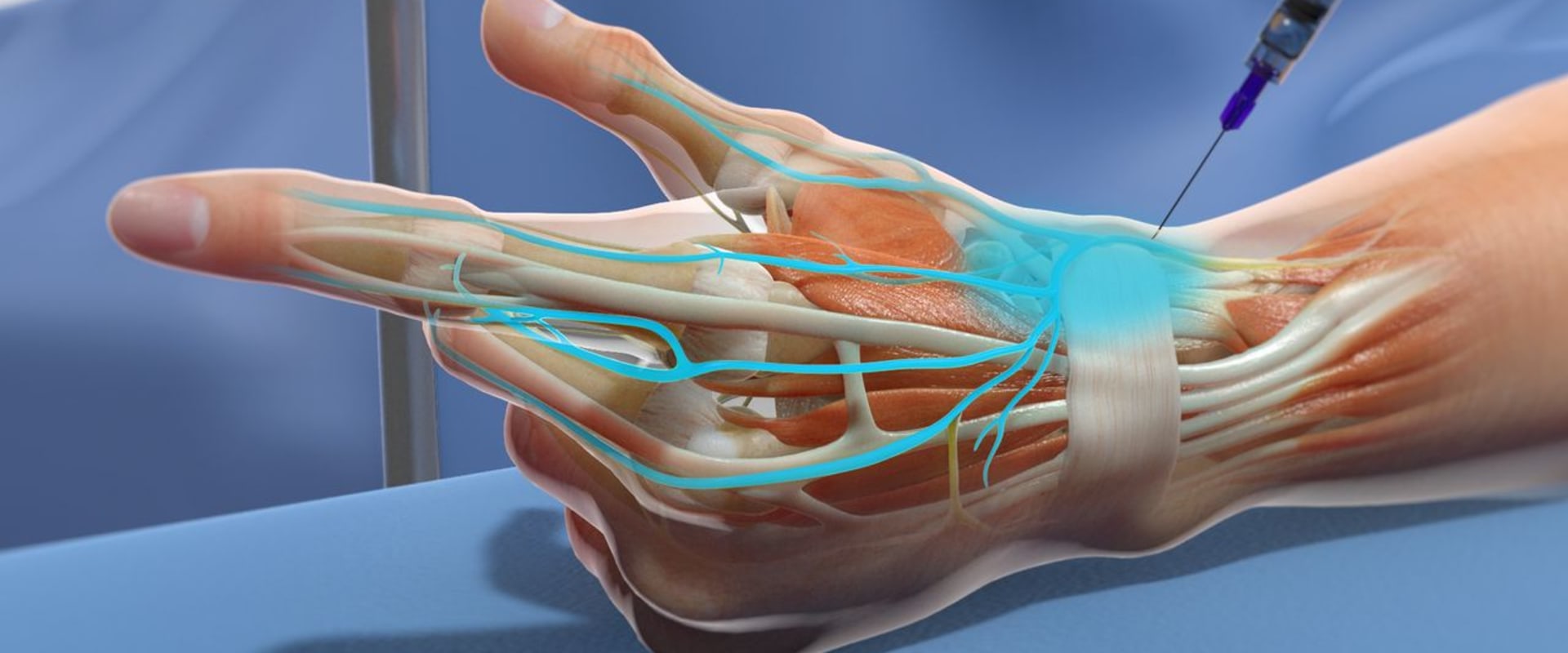 Managing Neuropathy at Home: The Benefits of Nerve Blocks