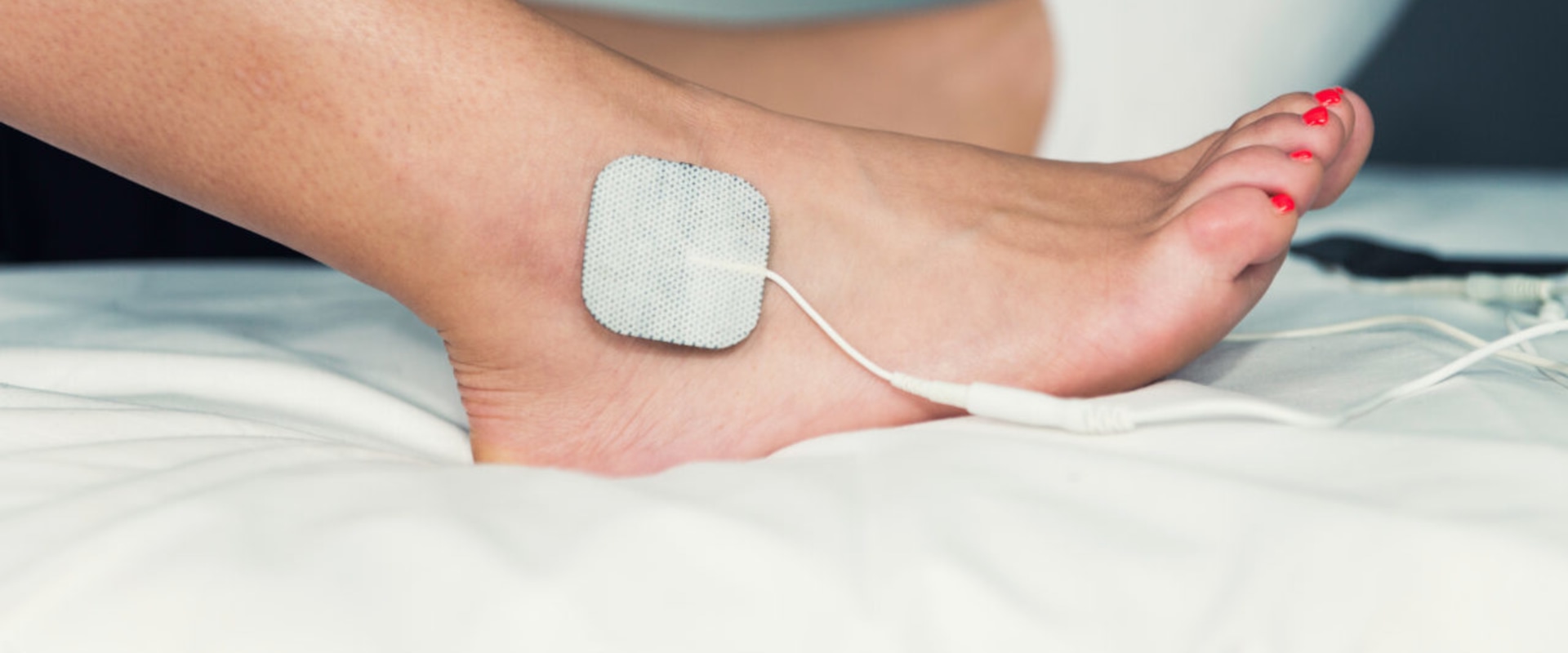 Treating Neuropathy at Home: The Use of Nerve Stimulation Devices