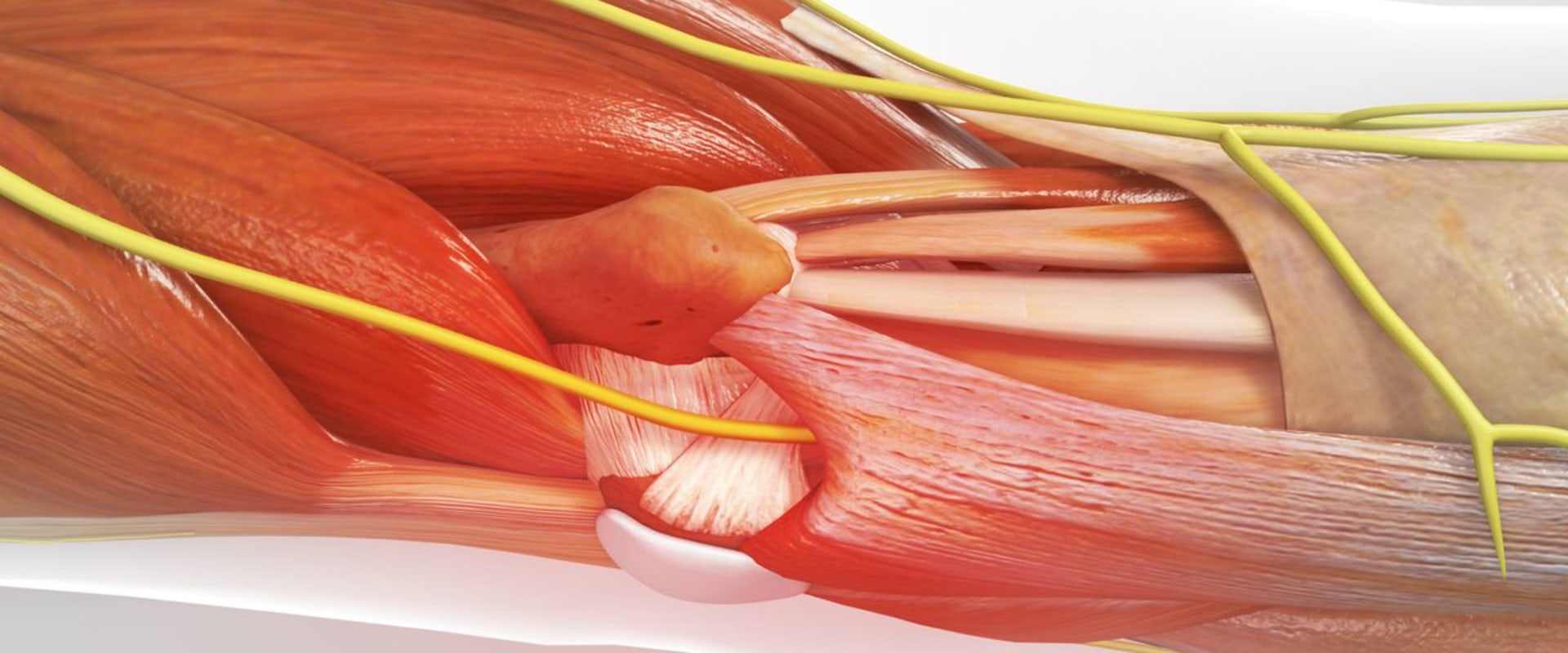 Expert Insights: Understanding Nerve Decompression Surgery for Neuropathy Treatment