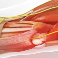 Expert Insights: Understanding Nerve Decompression Surgery for Neuropathy Treatment